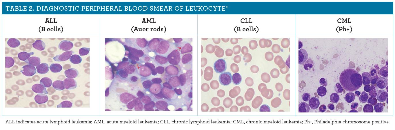 Sample images of AML, ALL, and other types of leukemia